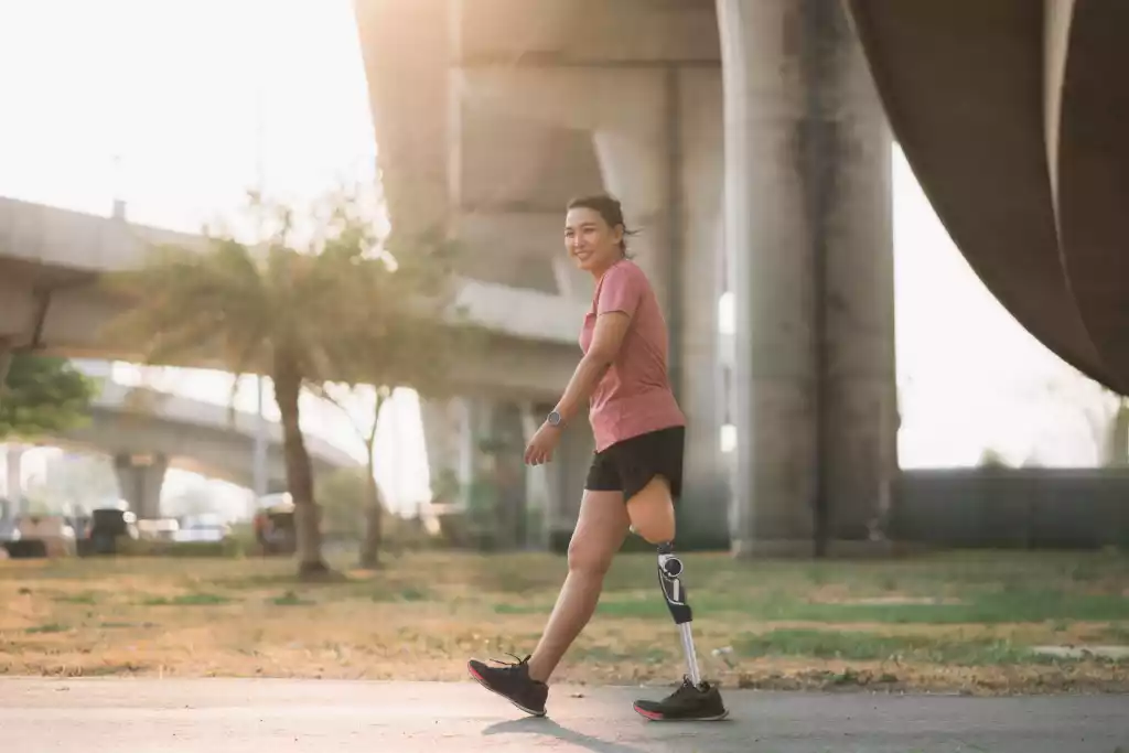 Женский протез ноги в центре протезирования и реабилитации